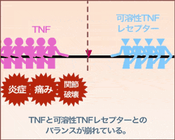 TNFのバランスのイメージ画像